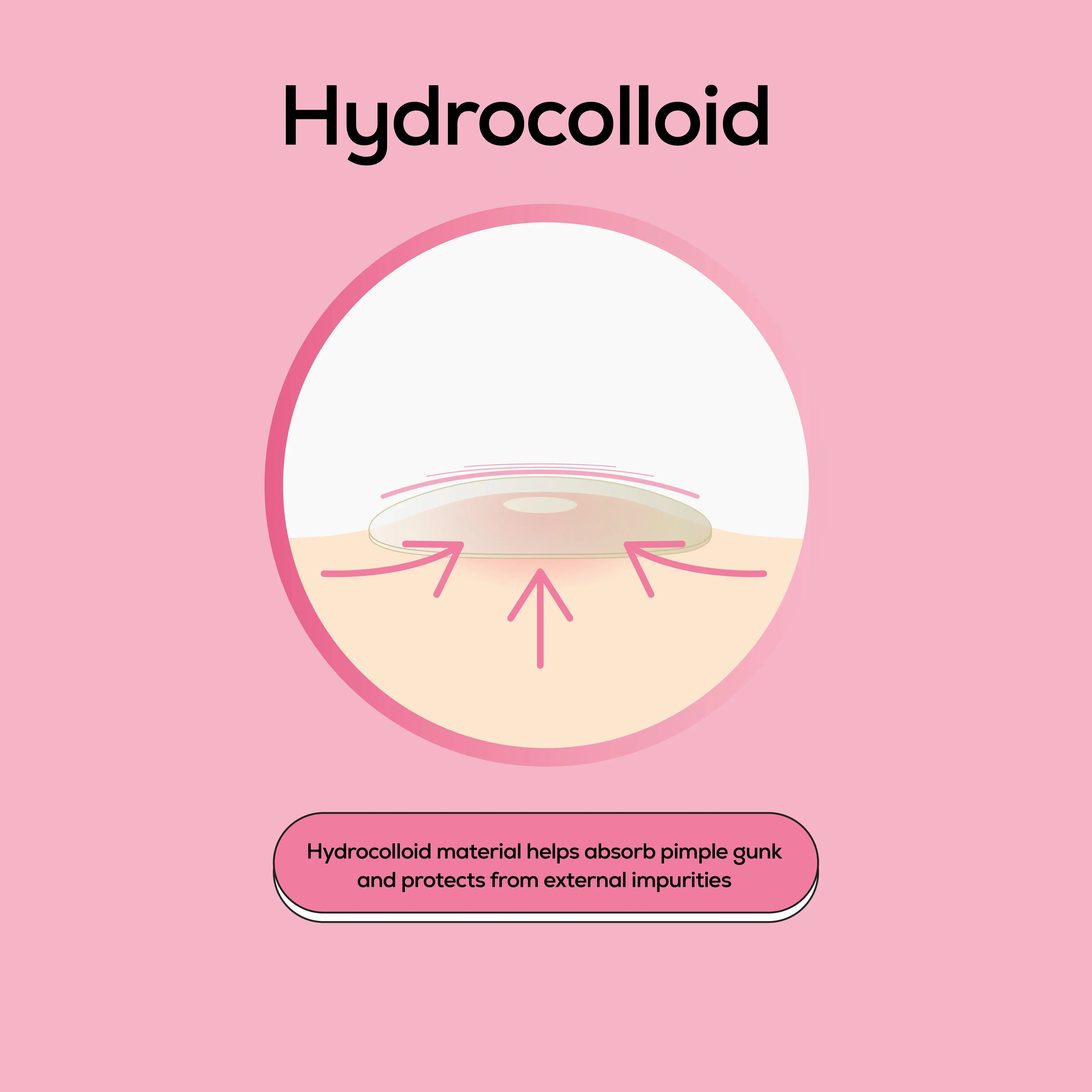 Hanhoo Hydrocolloid Blemish Patches for Acne Treatment and Skin Repair - Invisible Pimple Patches